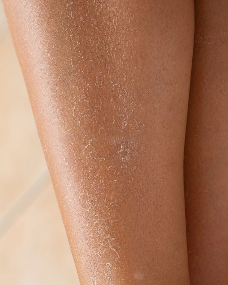 Body Dryness & Repair