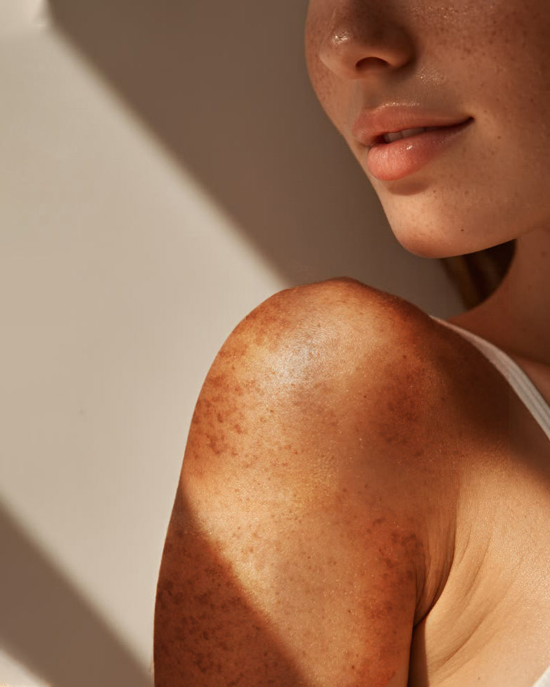 Body Pigmentation & Even Tone