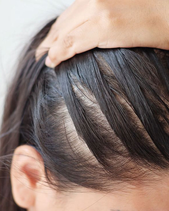 Hair Fall & Density